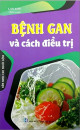 Bệnh gan và cách điều trị