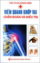 Viêm quanh khớp vai: chẩn đoán và điều trị