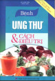 Bệnh ung thư và cách điều trị