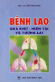 Bệnh lao quá khứ - hiện tại và tương lai